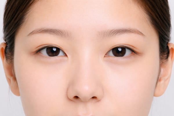 症例1 施術後