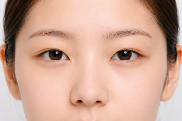 症例1 施術前