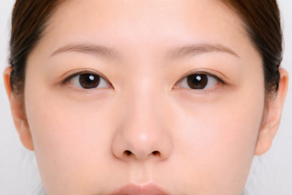症例2 施術後