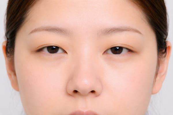 症例2 施術前