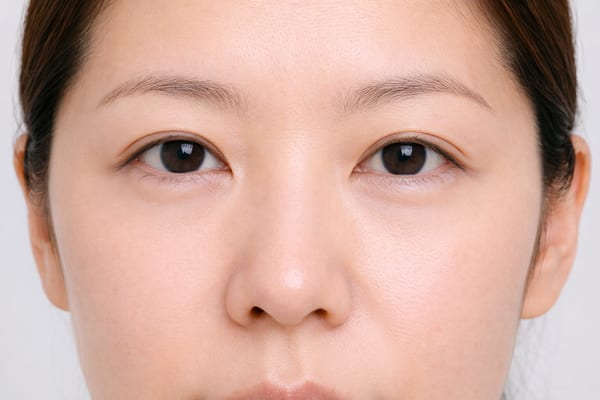 症例3 施術後