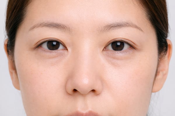 症例3 施術前