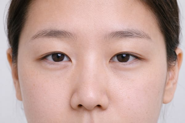 症例5 施術前