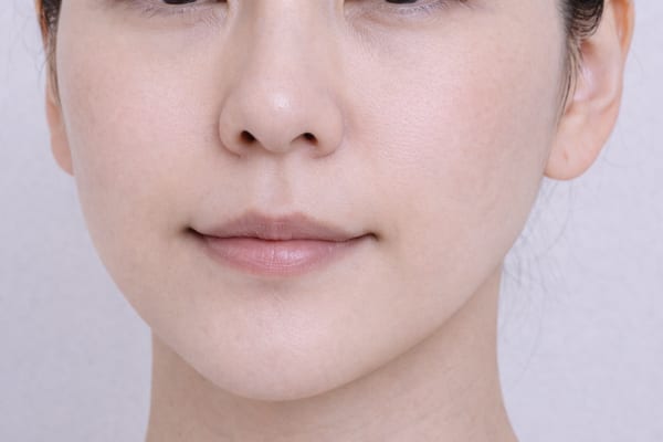 症例16 施術後