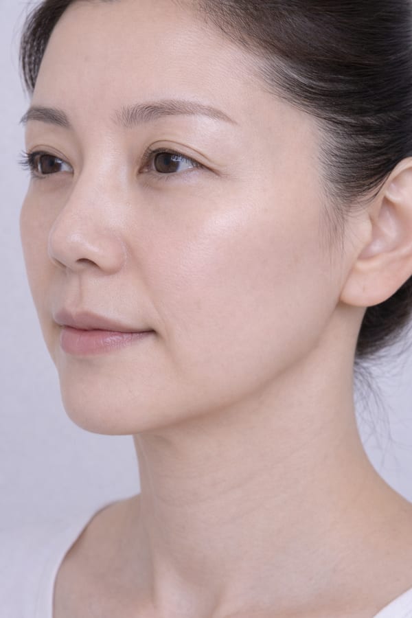 症例18 施術後