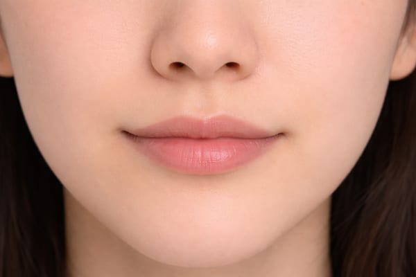 症例24 施術後
