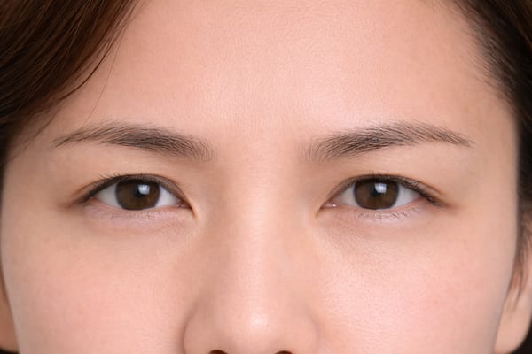 症例25 施術後