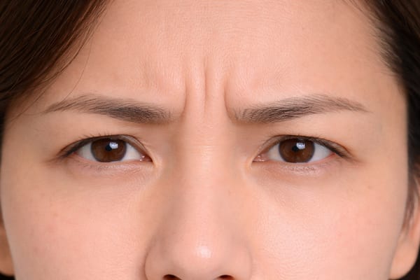 症例25 施術前