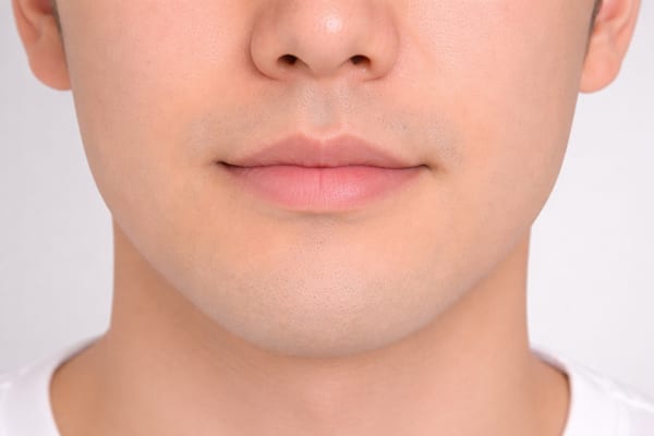 症例27 施術後